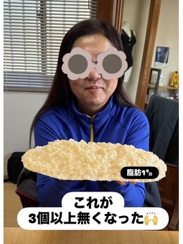 リンドール(RinDoll)/耳つぼダイエット/自律神経/小顔