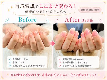 ケアビューティサロン(care beauty salon)の写真/お肌や地爪にやさしく、潤いを与えるシャイニージェルで美爪育成しながら楽しめる♪整えて綺麗な地爪へ◎