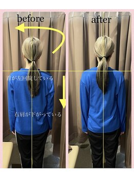 アイリー(Irie)/骨格矯正