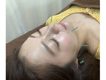 リアン(Re.庵)の写真/【鍼灸を受けるならRe.庵】辛いコリ＆疲れ解消！鍼灸×リラクメニューや満足度高い美容鍼SETメニューも多彩