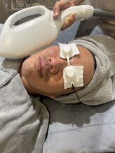 アリ(ALI)/ヒゲ脱毛ご予約増えております!!