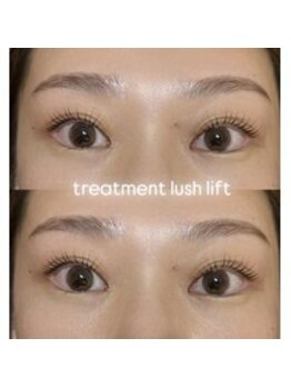 バニーアイズ 天神(Bunny eyes TENJIN)/トリートメントラッシュリフト