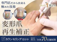 巻き爪補正店 久留米店の雰囲気(変形爪再生補正。肥厚したお爪を整えます)