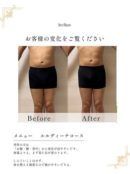 ヨサパーク ベルス(YOSA PARK bellus)/beforeafter