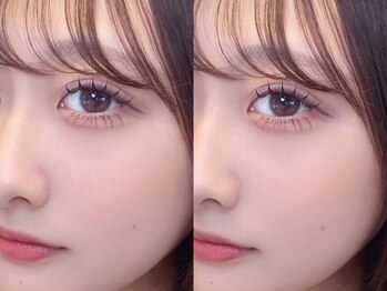 ミニョン バイ ベル 江坂店(Mignon by Belle)の写真/江坂駅すぐ