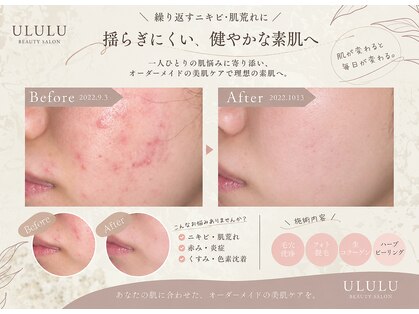 ウルル 上野店(ULULU)の写真