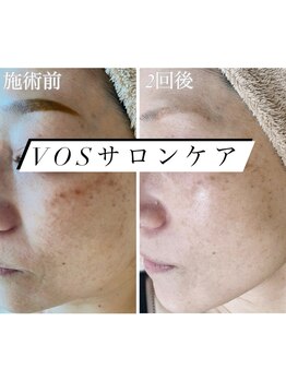 ビューティー アディクト(Beauty addict)/なりたい理想の肌へ
