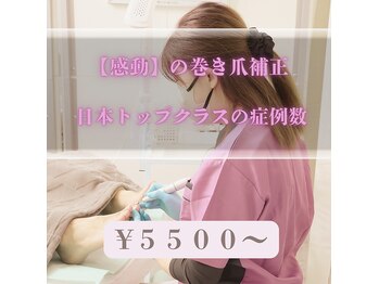 巻き爪補正店 大阪京橋店