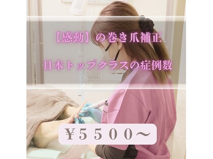 巻き爪補正店 大阪京橋店の写真