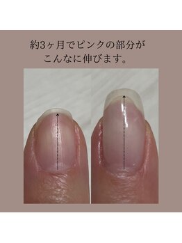 京都　パラジェル　フィルイン