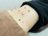 【その腰の痛みがクセになる前に！】腰痛鍼灸施術/30分