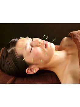 鍼灸施術を受けたい