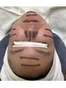 【大人気】イノスピキュール導入ケア・VOS肌質改善トリートメント