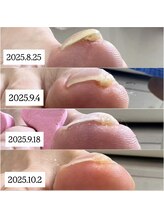 ケア ビューティー ネイル(care beauty NAIL)/