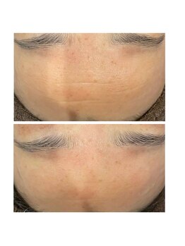 エクリュ(ecru)/シワもすっきり！