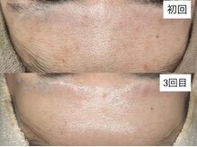 ベリスユイット(BELLIS HUIT)