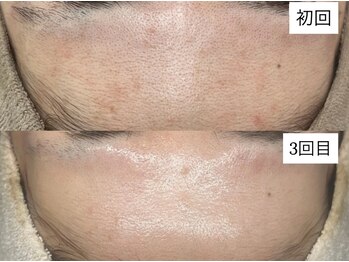 ベリスユイット(BELLIS HUIT)