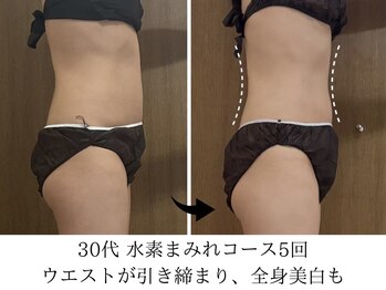 ヨサパーク タキ 上野毛(YOSA PARK TAKI)/30代・水素まみれコース5回