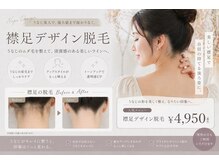 ちゅるん肌ドットコム 喜連瓜破店(ちゅるん肌.com)の雰囲気（業界最高峰の脱毛器導入！この夏、デザイン襟足脱毛も大人気！）