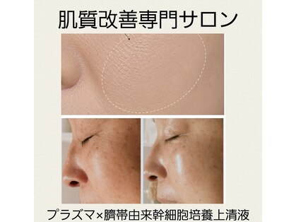 エスボーテ(sbeaute)の写真