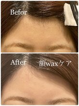 ノーティス 浦和(NOTICE)/大人気！お顔の脱毛/額WAXケア