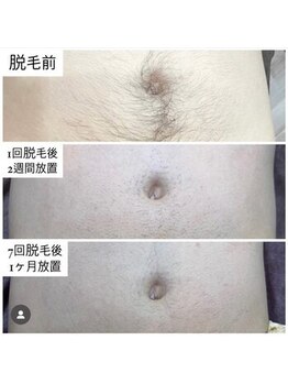 ルトゥール(Retour)/メンズ へそ周り