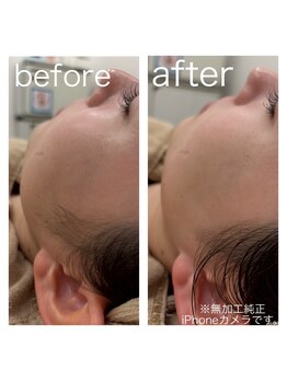 ラクシー 御徒町(luxssy)/もみあげシェービング