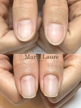 マリーロール 淀屋橋本店(Marie Laure)/自爪育成/深爪矯正/ネイルケア