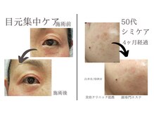 シミケア/シワケア/毛穴ケアも専門店にお任せ下さい！