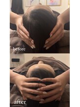 スリーピー 大阪本町/睡眠整体【四ツ橋心斎橋本町】