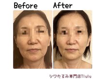 トルル(Tlulu)の雰囲気（【Before After】歪み、左右差は元に戻せる！筋骨矯正エイジング）