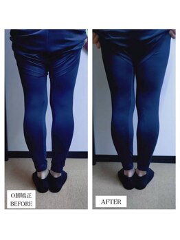 レディア 伊勢店(Re:Dear)/O脚矯正