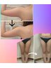 《ダイエット痩身》二の腕又は下半身ケアコース60分¥9300→¥7700