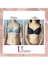 ウルエッテ(UluEtte)/バストアップと痩身/福岡痩身