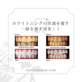 ホワイトニングショップ 阪急伊丹店