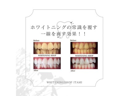 ホワイトニングショップ 阪急伊丹店の写真