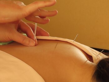 よもぎ堂 飯田橋の写真/当店一番人気【指圧マッサージ+鍼灸】身体を芯から温め代謝UP!自律神経を整え不調が出にくいお身体へ♪