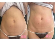 ゴールデンセル(golden cell)/