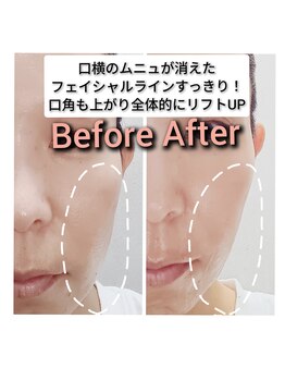 イージープラス つくば店(EASY+)/光フェイシャル