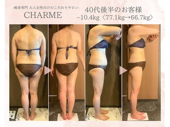 シャルム(charme)/効果抜群！ハイパーナイフEX痩身