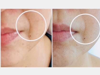 サロンドットブレスドットケイ(salon.bless.k)の写真