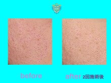 リュクス(LUXE)/ビフォーアフター