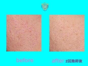 リュクス(LUXE)/ビフォーアフター