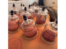 フィル鍼灸整体院の雰囲気(指圧→鍼灸→カッピング→整体により肩こり、腰痛に効果的◎)