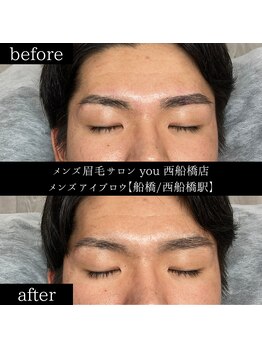 ユー 西船橋店(you)/ビフォーアフター写真