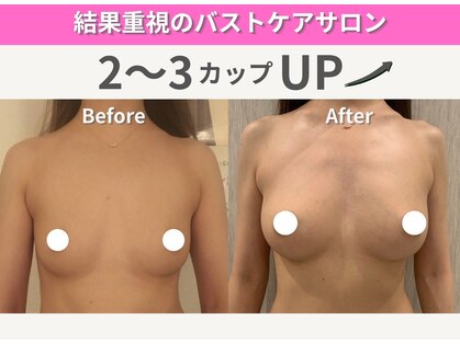 バストアップ専門店 ウェルバスト 福岡天神店(Well Bust)の写真