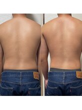 ティグレ 岡山店(TIGRE)/メンズも人気痩身（上半身）