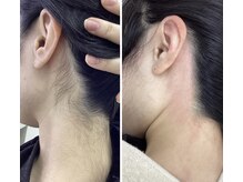 エレーナ 虎ノ門(Elena)の雰囲気（ブラジリアンでは不可能! 根元から抜ける♪美容師担当　メンズ可）