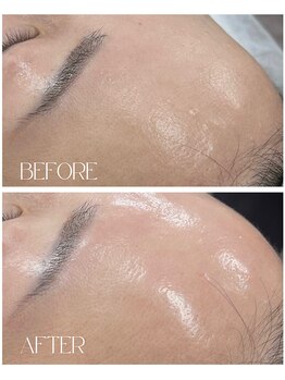 シュシュビエン(Chou Chou Bien)/ララピールで水光肌へ