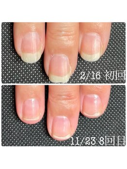 エヌ(N)/ネイリストMami限定